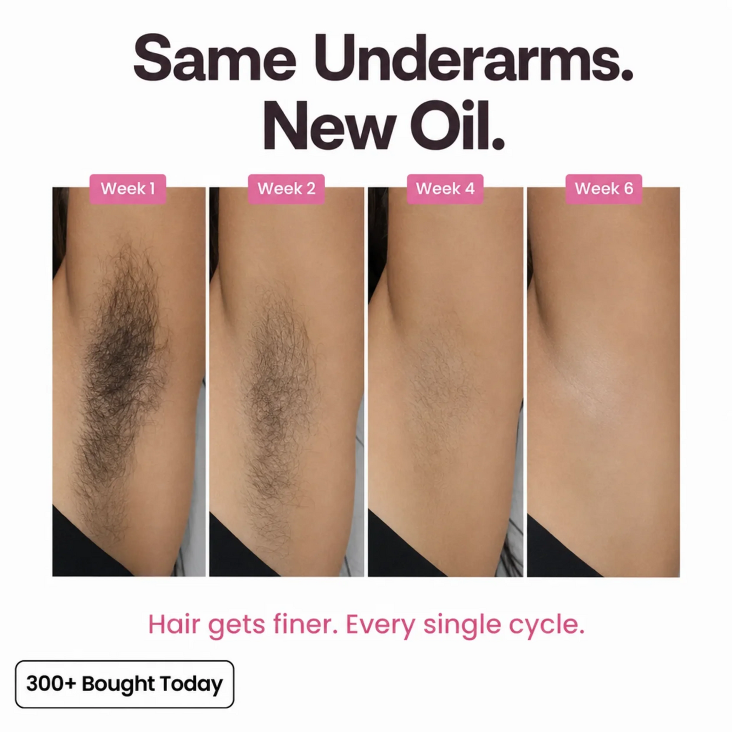 Anti-Hair Growth Oil